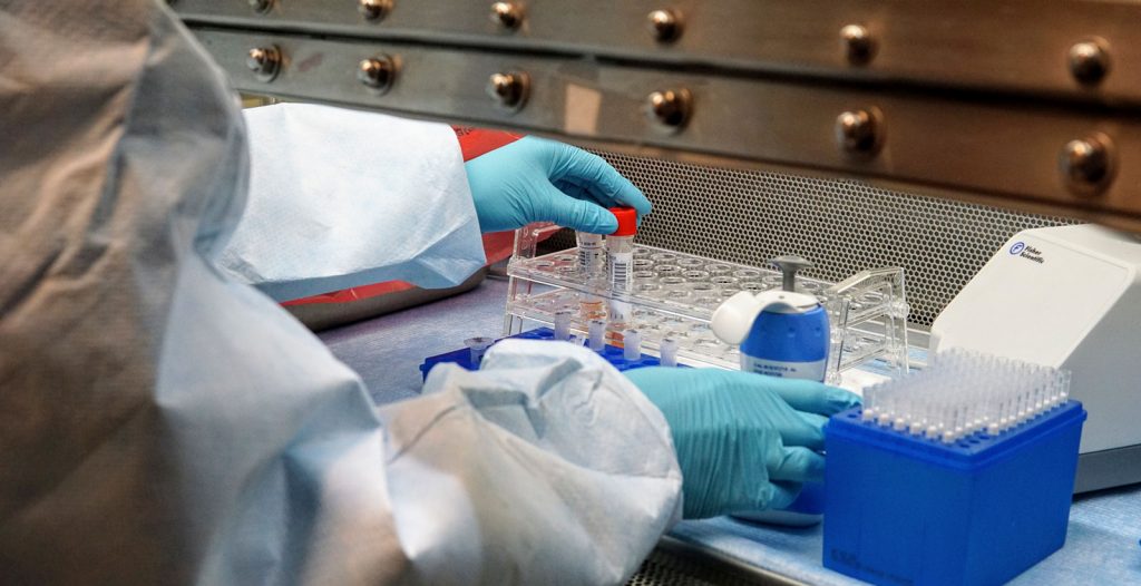 Šta se zaista zna o virusu Nipah i zašto nema razloga za uzbunu