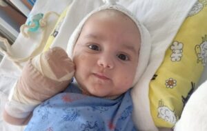 Mali Lazar iz Broda ostao bez prstiju nogu i ruku, potrebna pomoć za liječenje